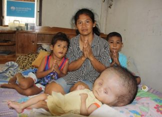 The Oumprasert family prays for a better future for young Nopakorn.